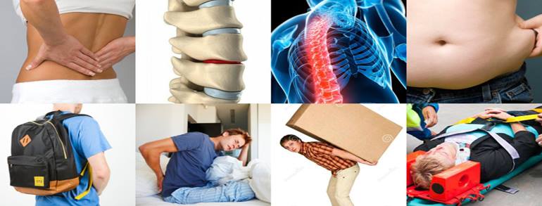 The Top 8 Causes of Low Back Pain